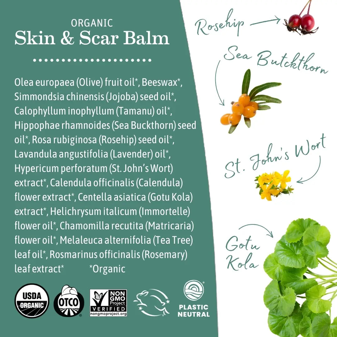 Organic Skin and Scar Balm, Earth Mama