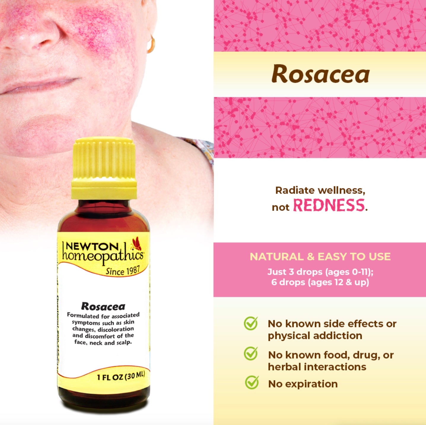 Rosacea, Liquid 1oz, Newton Homeopathics