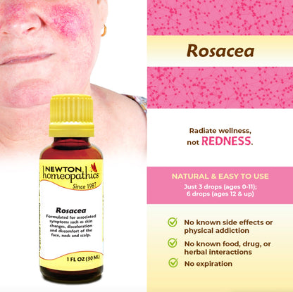 Rosacea, Liquid 1oz, Newton Homeopathics