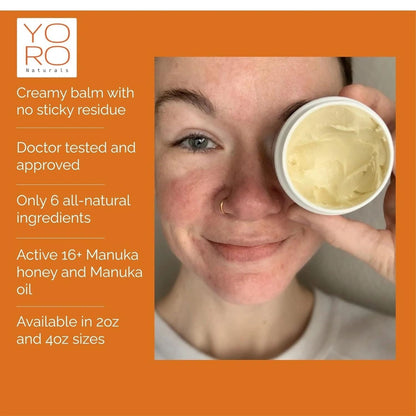 Organic Manuka Skin Soothing Cream, Original, YoRo Naturals